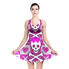 Reversible Skater Dress 