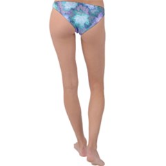 Ring Detail Bikini Bottoms 