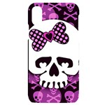 Pink Polka Dot Bow Skull iPhone X/XS Black UV Print Case